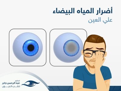 أضرار-المياه-البيضا-علي-العين - عبد الرحمن جابر اضرار المياه البيضاء في العين، أعرف اكثر مع د/عبد الرحمن
