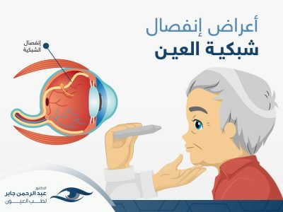 أعراض-إنفصال-شبكية-العين اعراض انفصال الشبكية