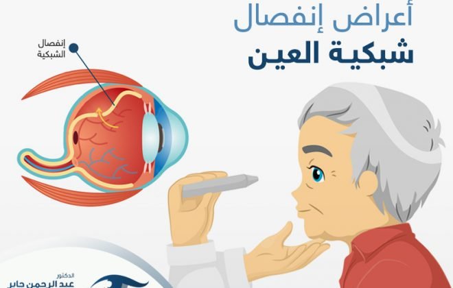 اعراض انفصال الشبكية