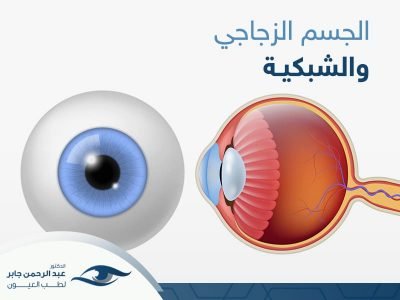 الجسم الزجاجي والشبكية - عبد الرحمن جابر الجسم الزجاجي والشبكية - عبد الرحمن جابر