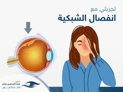 تجربتي مع انفصال الشبكية - عبد الرحمن جابر تجربتي مع انفصال الشبكية - عبد الرحمن جابر