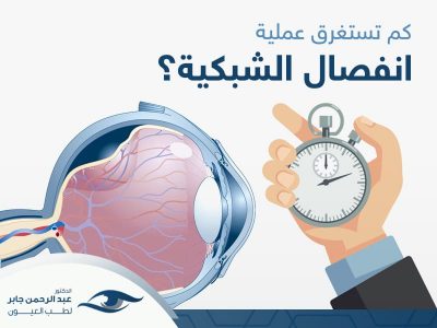 كم تستغرق عملية انفصال الشبكية مع د عبد الرحمن كم تستغرق عملية انفصال الشبكية مع د عبد الرحمن