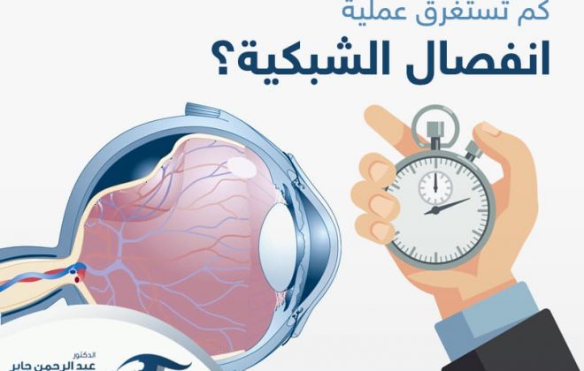 كم تستغرق عملية انفصال الشبكية مع د عبد الرحمن
