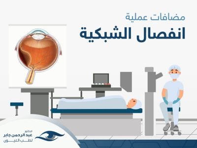 مضاعفات عملية انفصال الشبكية - د عبد الرحمن مضاعفات عملية انفصال الشبكية - د عبد الرحمن
