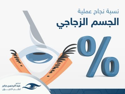نسبة-نجاح-عملية-الجسم-الزجاجي نسبة نجاح عملية الجسم الزجاجي