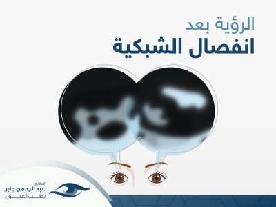 الرؤية-بعد-انفصال-الشبكية (1) الرؤية بعد انفصال الشبكية