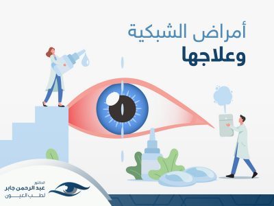 امراض الشبكية وعلاجها