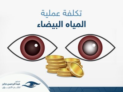 تكلفة-عملية-المياه-البيضاء-في-العين تكلفة عملية المياه البيضاء