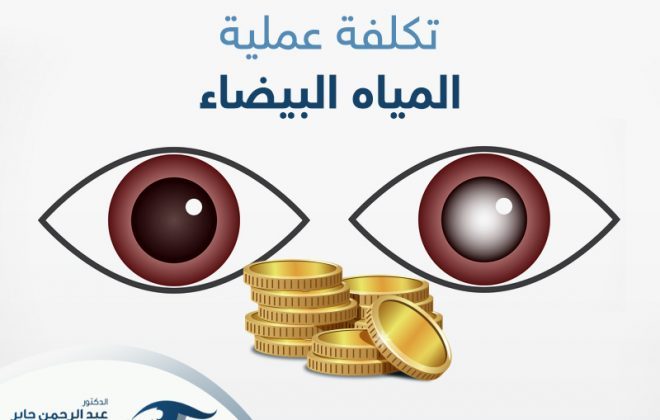تكلفة عملية المياه البيضاء