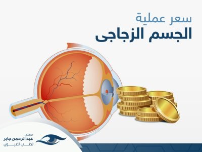 سعر-عملية-الجسم-الزجاجي-في-العين سعر عملية الجسم الزجاجي في العين