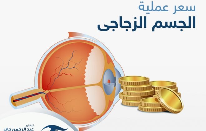 سعر عملية الجسم الزجاجي في العين