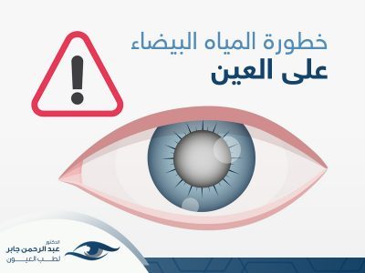 خطورة المياه البيضاء على العين
