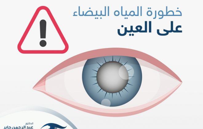 خطورة المياه البيضاء على العين