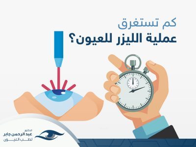 كم تستغرق عملية الليزر للعيون