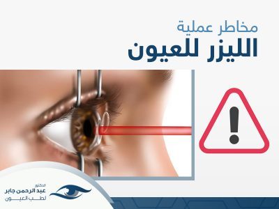 مخاطر عملية الليزر للعيون