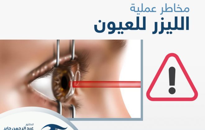 مخاطر عملية الليزر للعيون