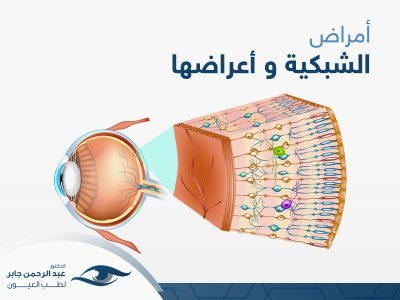 امراض الشبكية واعراضها