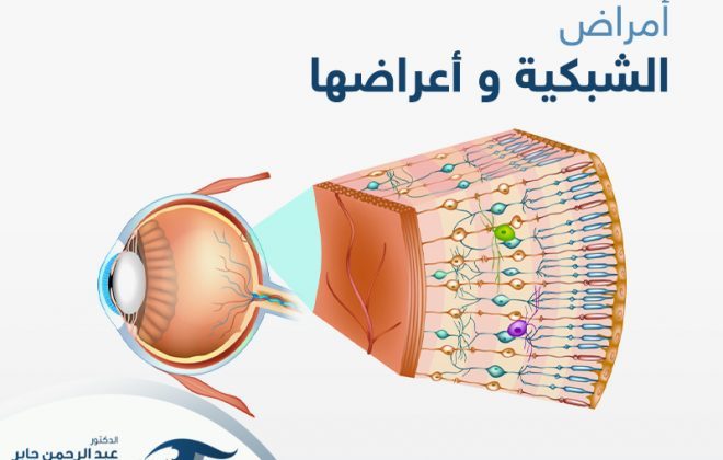 امراض الشبكية واعراضها