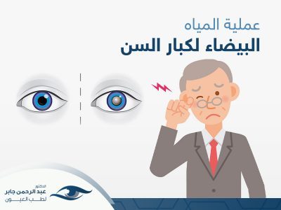 عملية المياه البيضاء لكبار السن