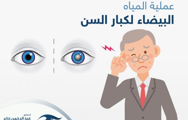 عملية المياه البيضاء لكبار السن
