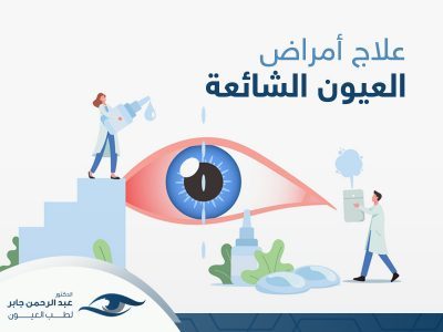 علاج امراض العين