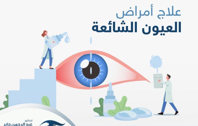 علاج امراض العين