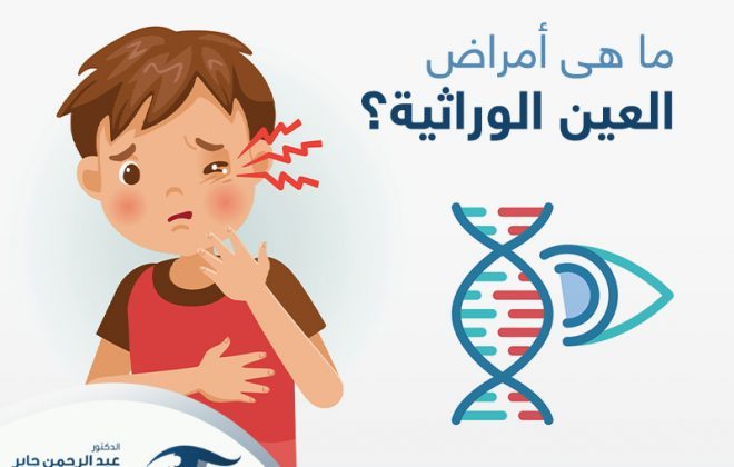 امراض العين الوراثية