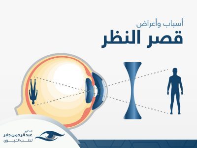 اسباب قصر النظر وأعراضه