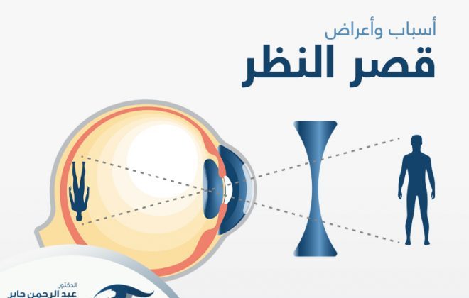 اسباب قصر النظر وأعراضه